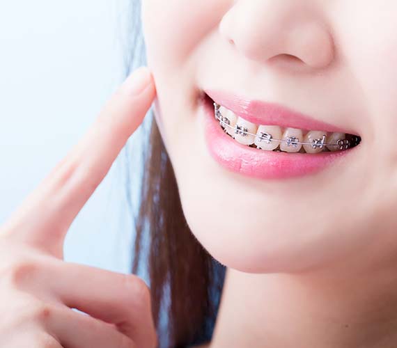 矯正歯科・小児矯正歯科 